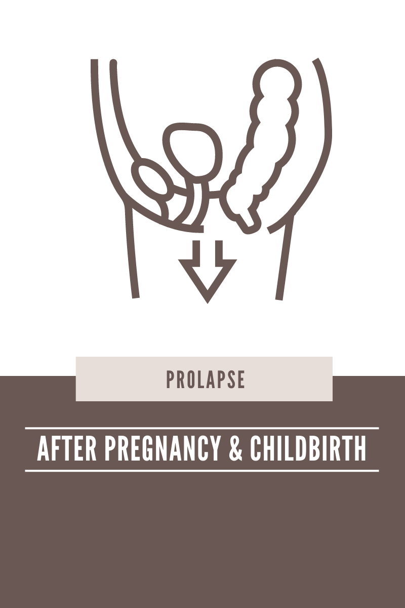 Prolapse after Childbirth: What it is and How To Treat it
